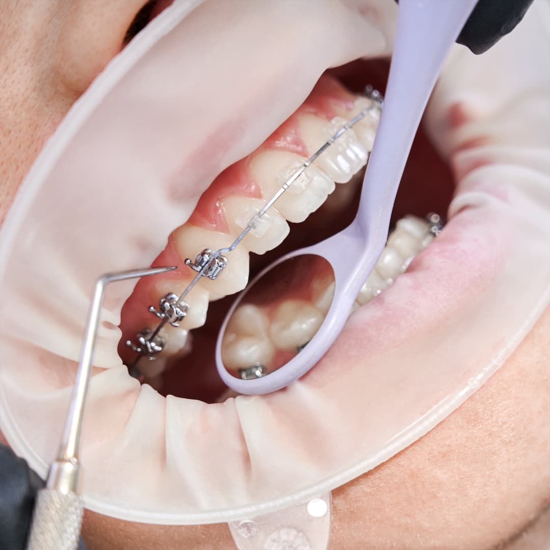 Ortodoncia, Endodoncia y Periodoncia