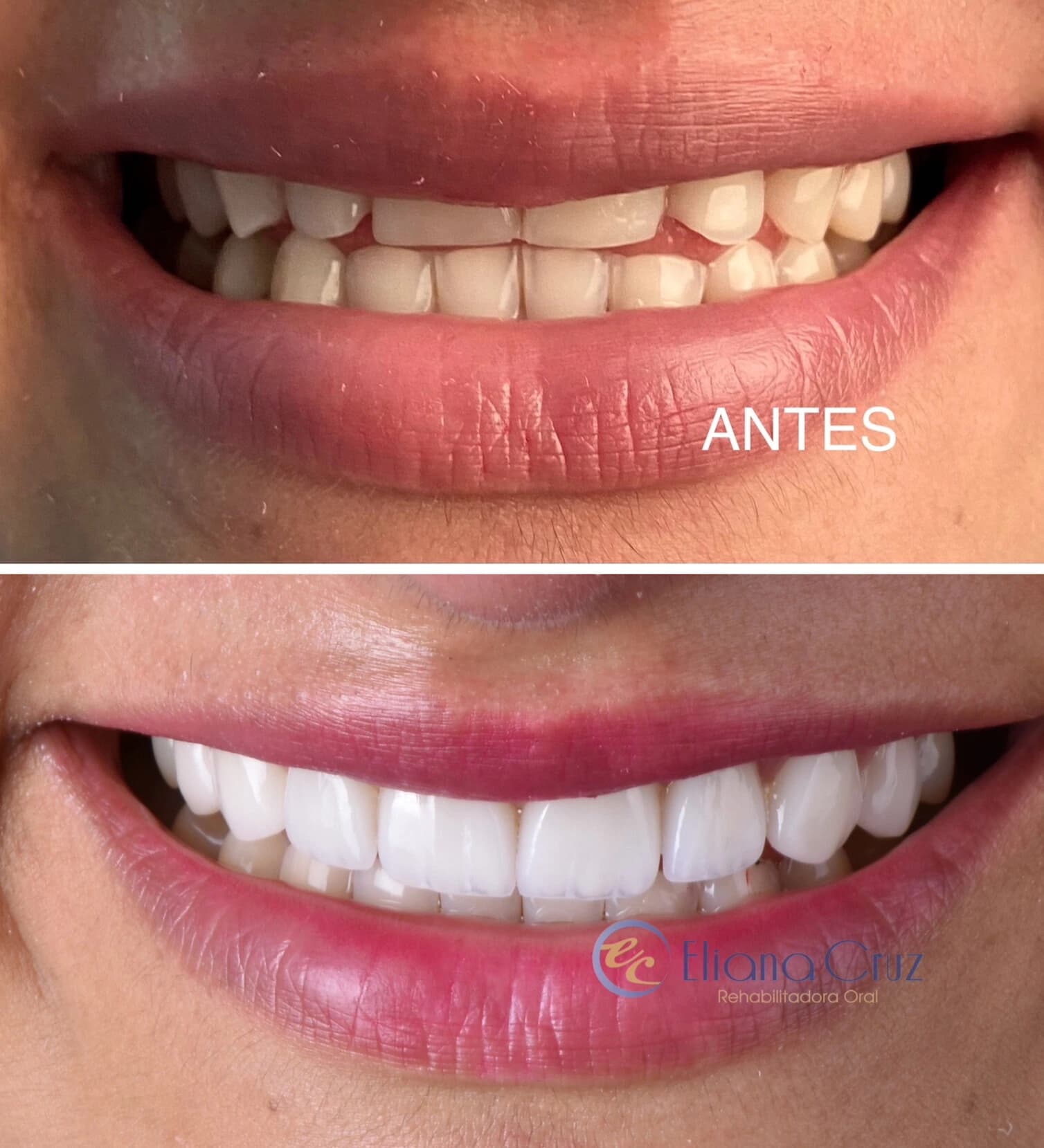 Resultado odontológico