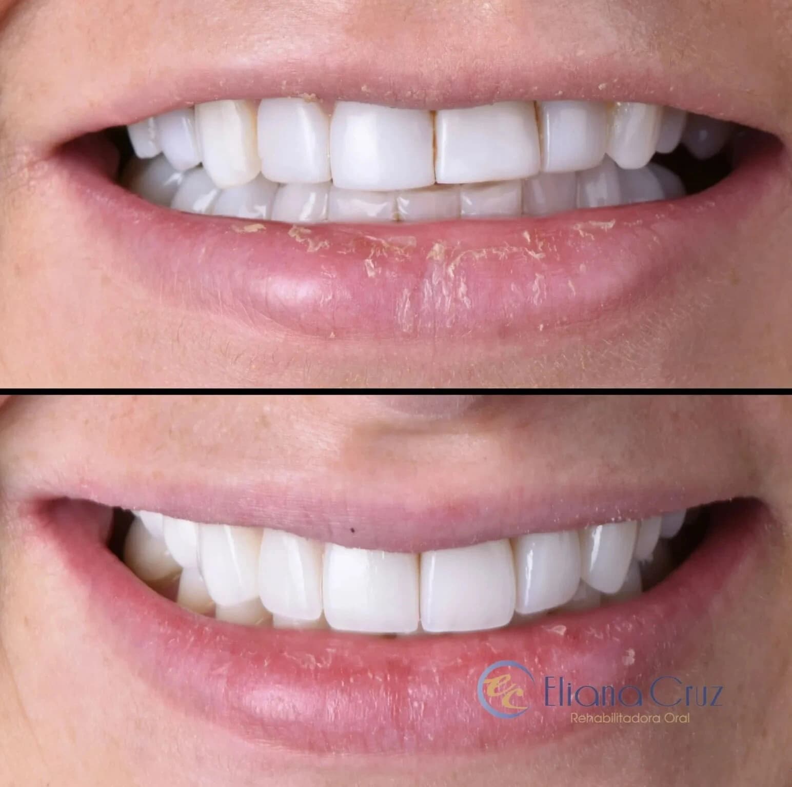 Resultado odontológico